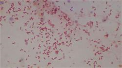 estudiar enfermedades tropicales bacterianas
