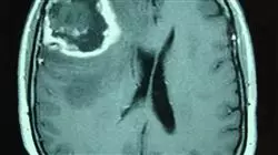 ##IMAGE##