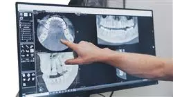 diplomado online analisis cefalometrico fotografia odontologica